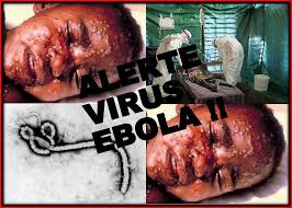 ebola